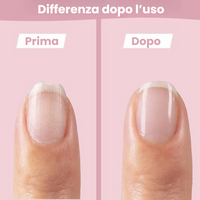 Thumbnail for SafeCare – Silenzioso e sicuro – Set elettrico per limare le unghie dei bambini